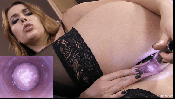 1bb