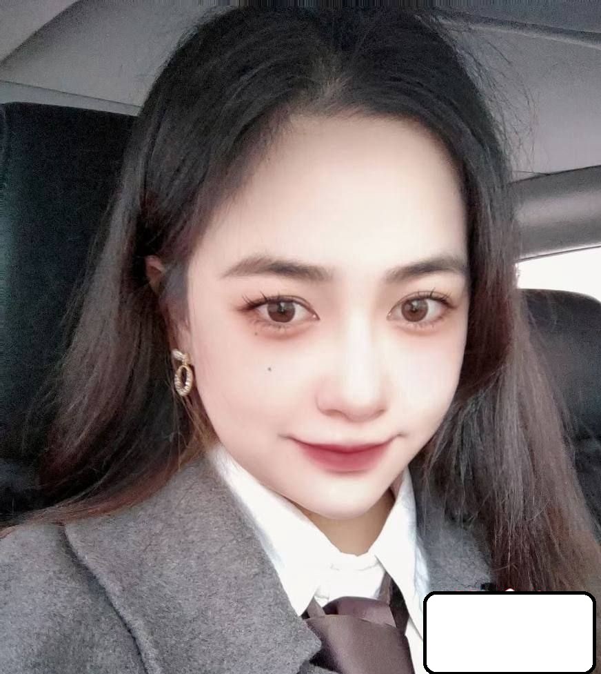 2dd
